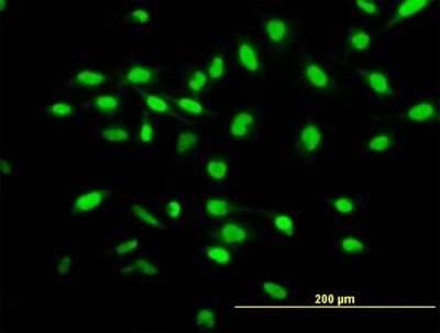 Immunocytochemistry/Immunofluorescence: WISP-1/CCN4 Antibody [H00008840-B01P] - Analysis of purified antibody to WISP1 on HeLa cell. (antibody concentration 10 ug/ml)