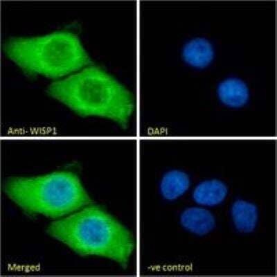 Immunocytochemistry/Immunofluorescence: WISP-1/CCN4 Antibody [NB100-77339] - Immunofluorescence analysis of paraformaldehyde fixed A431 cells, permeabilized with 0.15% Triton. Primary incubation 1hr (10ug/ml) followed by Alexa Fluor 488 secondary antibody (2ug/ml), showing cytoplasmic staining. The nuclear stain is DAPI (blue). Negative control: Unimmunized goat IgG (10ug/ml) followed by Alexa Fluor 488 secondary antibody (2ug/ml).