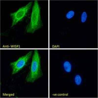Immunocytochemistry/Immunofluorescence: WISP-1/CCN4 Antibody [NB100-77339] - Immunofluorescence analysis of paraformaldehyde fixed U2OS cells, permeabilized with 0.15% Triton. Primary incubation 1hr (10ug/ml) followed by Alexa Fluor 488 secondary antibody (2ug/ml), showing cytoplasmic staining. The nuclear stain is DAPI (blue). Negative control: Unimmunized goat IgG (10ug/ml) followed by Alexa Fluor 488 secondary antibody (2ug/ml).