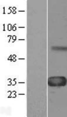 Western Blot: WISP1 Overexpression Lysate (Adult Normal) [NBL1-17856] Left-Empty vector transfected control cell lysate (HEK293 cell lysate); Right -Over-expression Lysate for WISP1.