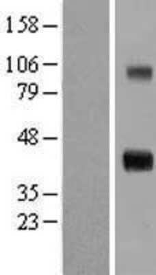 Western Blot: WISP1 Overexpression Lysate (Adult Normal) [NBL1-17857] Left-Empty vector transfected control cell lysate (HEK293 cell lysate); Right -Over-expression Lysate for WISP1.