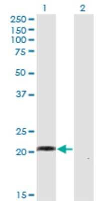Western Blot: WISP2 Antibody (1E11) [H00008839-M02] - Analysis of WISP2 expression in transfected 293T cell line by WISP2 monoclonal antibody (M02), clone 1E11.Lane 1: WISP2 transfected lysate(26.8 KDa).Lane 2: Non-transfected lysate.