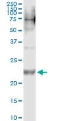 Immunoprecipitation: WISP2 Antibody (3D10) [H00008839-M09] - Analysis of WISP2 transfected lysate using anti-WISP2 monoclonal antibody and Protein A Magnetic Bead, and immunoblotted with WISP2 rabbit polyclonal antibody.