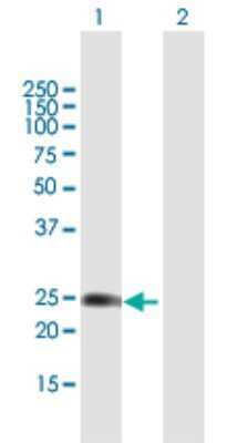 Western Blot: WISP2 Antibody [H00008839-B01P] - Analysis of WISP2 expression in transfected 293T cell line by WISP2 polyclonal antibody.  Lane 1: WISP2 transfected lysate(27.5 KDa). Lane 2: Non-transfected lysate.