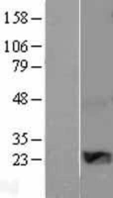 Western Blot: WISP2 Overexpression Lysate (Adult Normal) [NBL1-17858] Left-Empty vector transfected control cell lysate (HEK293 cell lysate); Right -Over-expression Lysate for WISP2.