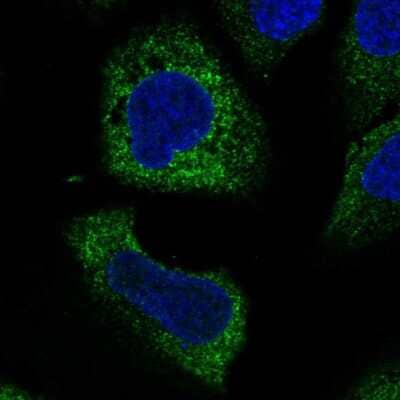 Immunocytochemistry/Immunofluorescence: WISP3 Antibody [NBP2-56060] - Staining of human cell line U-2 OS shows localization to endoplasmic reticulum.