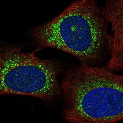 Immunocytochemistry/Immunofluorescence: WISP3 Antibody [NBP2-69068] - Staining of human cell line U-2 OS shows localization to endoplasmic reticulum.