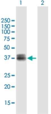 Western Blot: WISP3 Antibody [H00008838-B01P-50ug] - Expression in transfected 293T cell line. Lane 1: WISP3 transfected lysate(41.40 KDa). Lane 2: Non-transfected lysate.