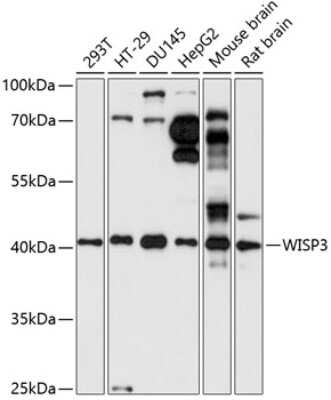 Western Blot: WISP3 Antibody [NBP2-93872] - Analysis of extracts of various cell lines, using WISP3 at 1:1000 dilution. Secondary antibody: HRP Goat Anti-Rabbit IgG (H+L) at 1:10000 dilution. Lysates/proteins: 25ug per lane. Blocking buffer: 3% nonfat dry milk in TBST. Detection: ECL Basic Kit . Exposure time: 30s.