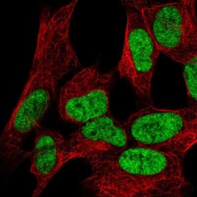 Immunocytochemistry/Immunofluorescence: WIZ Antibody [NBP2-58557] - Staining of human cell line SH-SY5Y shows localization to nucleoplasm. Antibody staining is shown in green. 