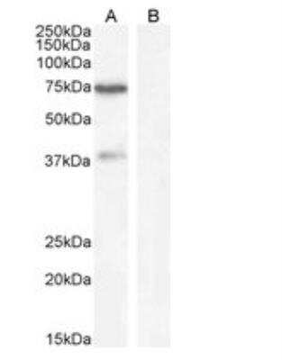 Western Blot: WIZ Antibody [NBP1-21059] - Human Cerebellum lysate (A) + Blocking peptide (B) (35 ug protein in RIPA buffer). Antibody at 1 ug/mL. Detected by chemiluminescence