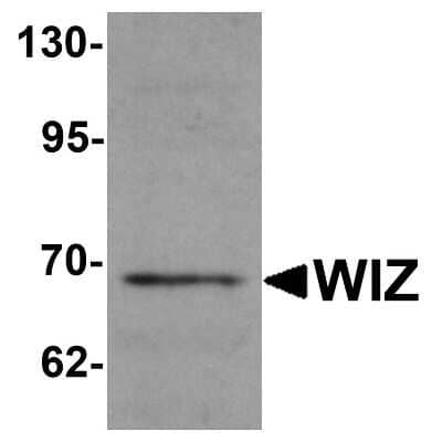 Western Blot: WIZ Antibody [NBP1-76515] - Analysis of rat lung tissue lysate with WIZ antibody at 1 ug/mL.