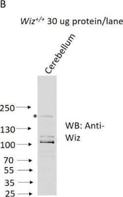 WIZ-Antibody-Western-Blot-NBP1-80586-img0006.jpg