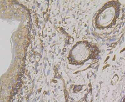 Immunohistochemistry-Paraffin: WNK1 Antibody (JG36-91) [NBP2-75712] - Analysis of paraffin-embedded human skin tissue using anti-WNK1 antibody. Counter stained with hematoxylin.