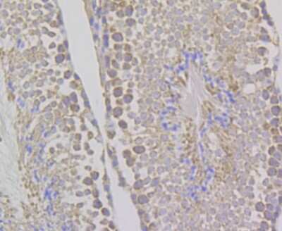Immunohistochemistry-Paraffin: WNK1 Antibody (JG36-91) [NBP2-75712] - Analysis of paraffin-embedded mouse testis tissue using anti-WNK1 antibody. Counter stained with hematoxylin.