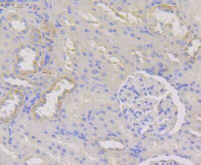 Immunohistochemistry-Paraffin: WNK1 Antibody (JG36-91) [NBP2-75712] - Analysis of paraffin-embedded rat kidney tissue using anti-WNK1 antibody. Counter stained with hematoxylin.