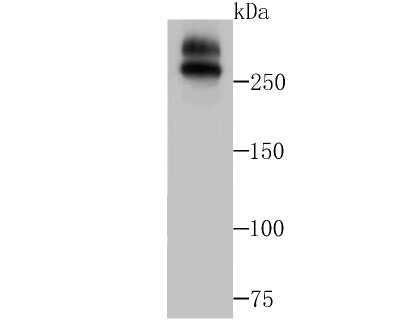 Western Blot: WNK1 Antibody (JG36-91) [NBP2-75712] - Analysis of WNK1 on A549 cell lysates using anti-WNK1 antibody at 1/1,000 dilution.