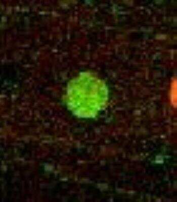 Microarray: WNK2 Antibody [25910002] - Antibody was printed on custom arrays and incubated with fluorescently labeled human EDTA plasma. Microarray image submitted by a verified customer review.