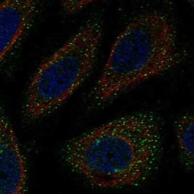 Immunocytochemistry/Immunofluorescence: WNK3 Antibody [NBP2-57909] - Staining of human cell line SiHa shows localization to vesicles.