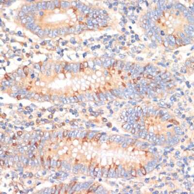 Immunohistochemistry-Paraffin: WNK3 Antibody [NBP2-94269] - Human appendix using WNK3 antibody at dilution of 1:100 (40x lens).