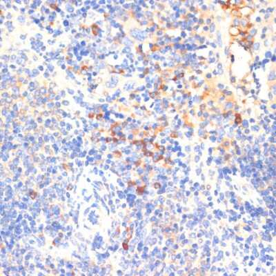 Immunohistochemistry-Paraffin: WNK3 Antibody [NBP2-94269] - Mouse spleen using WNK3 antibody at dilution of 1:100 (40x lens).