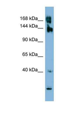 Western Blot: WNK3 Antibody [NBP1-58361] - ACHN cell lysate, concentration 0.2-1 ug/ml.