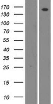 Western Blot: WNK4 Overexpression Lysate (Adult Normal) [NBP2-06033] Left-Empty vector transfected control cell lysate (HEK293 cell lysate); Right -Over-expression Lysate for WNK4.