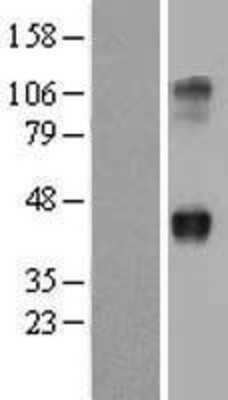 Western Blot: WNT2 Overexpression Lysate (Adult Normal) [NBL1-17866] Left-Empty vector transfected control cell lysate (HEK293 cell lysate); Right -Over-expression Lysate for WNT2.