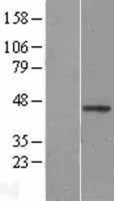 Western Blot: WNT2B Overexpression Lysate (Adult Normal) [NBL1-17868] Left-Empty vector transfected control cell lysate (HEK293 cell lysate); Right -Over-expression Lysate for WNT2B.