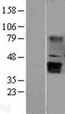 Western Blot Wnt-5b Overexpression Lysate