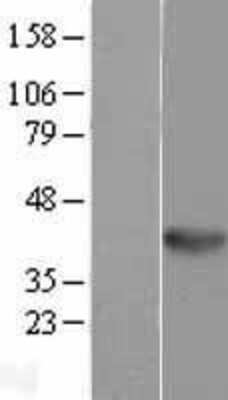 Western Blot: WNT5B Overexpression Lysate (Adult Normal) [NBL1-17874] - Western Blot experiments.  Left-Control; Right -Over-expression Lysate for WNT5B