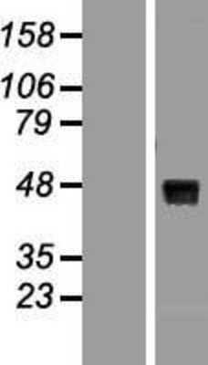 Western Blot: WNT8A Overexpression Lysate (Adult Normal) [NBL1-17878] Left-Empty vector transfected control cell lysate (HEK293 cell lysate); Right -Over-expression Lysate for WNT8A.