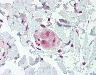 Immunohistochemistry-Paraffin WRCH1 Antibody