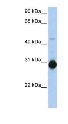 Western Blot WRCH1 Antibody