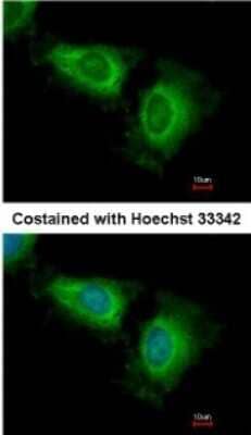 Immunocytochemistry/Immunofluorescence: WSB2 Antibody [NBP2-15164] - Paraformaldehyde-fixed HeLa, using antibody at 1:500 dilution.