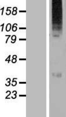 Western Blot: WSB2 Overexpression Lysate (Adult Normal) [NBL1-17884] Left-Empty vector transfected control cell lysate (HEK293 cell lysate); Right -Over-expression Lysate for WSB2.