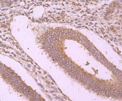 Immunohistochemistry-Paraffin: WSCD2 Antibody (9-F3) [NBP2-75715] - Analysis of paraffin-embedded human uterus tissue using anti-WSCD2 antibody. Counter stained with hematoxylin.