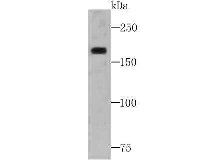 Western Blot: WSTF Antibody (JG36-32) [NBP2-76878] - Western blot analysis of WSTF on SiHa cell lysates using anti-WSTF at 1/500 dilution.