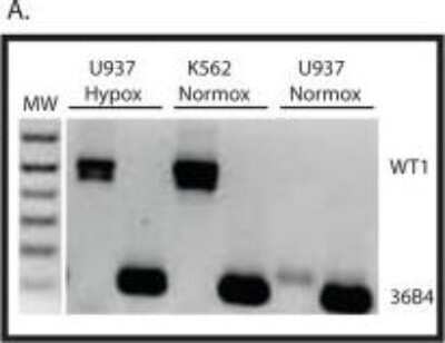 Western Blot: WT1 Antibody (6F-H2) - Azide and BSA Free [NBP2-81012] - Hypomethylation of the Intron 1 CpG island results in WT1 expression. RNA was isolated from K562 and U937 cells growing under atmospheric conditions (Normox) and from U937 cells growing in 1% O2 (Hypox) and was analyzed by RT-PCR using primers that span exon 5 of the WT1 mRNA. Ribosomal RNA 36B4 is used as a positive control, and molecular weight markers (MW) are shown. Image collected and cropped by CiteAb from the following publication (//dx.plos.org/10.1371/journal.pone.0119837), licensed under a CC-BY license. Image from the standard format of this antibody.