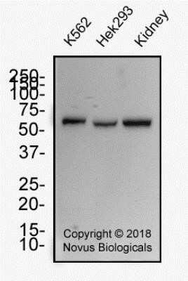 Western Blot: WT1 Antibody (6F-H2) - Azide and BSA Free [NBP2-81012] - Whole cell protein from human K562, HEK293 and kidney tissue was separated on a 12% gel by SDS-PAGE, transferred to PVDF membrane and blocked in 5% non-fat milk in TBST. The membrane was probed with 2.0 ug/ml anti-WT1 in block buffer and detected with an anti-mouse HRP secondary antibody using chemiluminescence. Image from the standard format of this antibody.