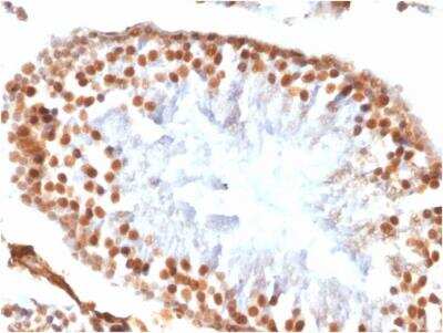 Immunohistochemistry-Paraffin: WT1 Antibody (WT1/1434R) - Azide and BSA Free [NBP3-11622] - Formalin-fixed, paraffin-embedded Rat Testis stained with WT1 Antibody (WT1/1434R).