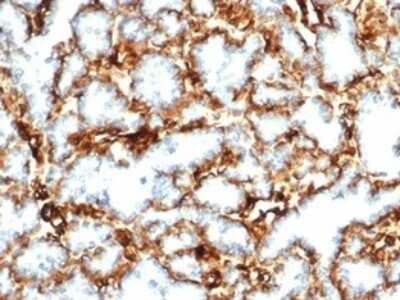 Immunohistochemistry-Paraffin: WT1 Antibody (WT1/3477R) - Azide and BSA Free [NBP3-08966] - FFPE human kidney. Secondary antibody only negative control. Hematoxylin counterstain.