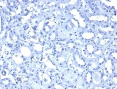 Immunohistochemistry-Paraffin: WT1 Antibody (WT1/3477R) - Azide and BSA Free [NBP3-08966] - FFPE human kidney. PBS instead of primary antibody. Secondary antibody only negative control. Hematoxylin counterstain.