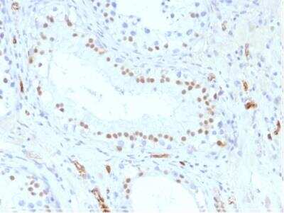 Immunohistochemistry-Paraffin: WT1 Antibody (WT1/857) - Azide and BSA Free [NBP2-47931] - Human Testis stained with Wilm's Tumor Mouse Monoclonal Antibody (WT1/857).