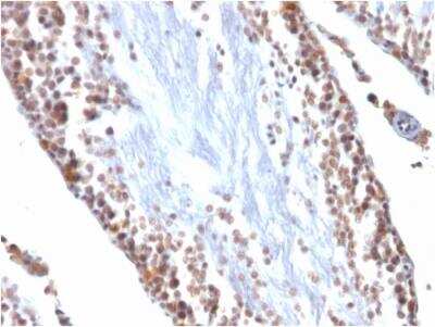 Immunohistochemistry-Paraffin: WT1 Antibody (WT1/857) - Azide and BSA Free [NBP2-47931] - Rat Testis stained with Wilm's Tumor Mouse Monoclonal Antibody (WT1/857).