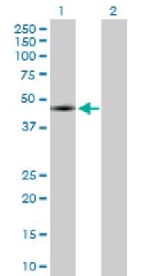 Western Blot: WT1 Antibody [H00007490-D01P] - Analysis of WT1 expression in transfected 293T cell line by WT1 polyclonal antibody.Lane 1: WT1 transfected lysate(34.50 KDa).Lane 2: Non-transfected lysate.