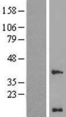 Western Blot: WW domain binding protein 5 Overexpression Lysate (Adult Normal) [NBP2-11181] Left-Empty vector transfected control cell lysate (HEK293 cell lysate); Right -Over-expression Lysate for WW domain binding protein 5.