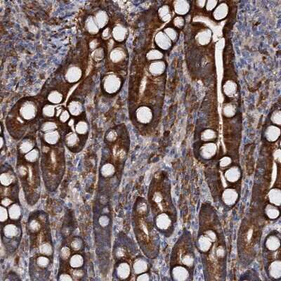 Immunohistochemistry-Paraffin: WWC3 Antibody [NBP1-90755] - Staining of human duodenum shows strong  granular cytoplasmic positivity in glandular cells.