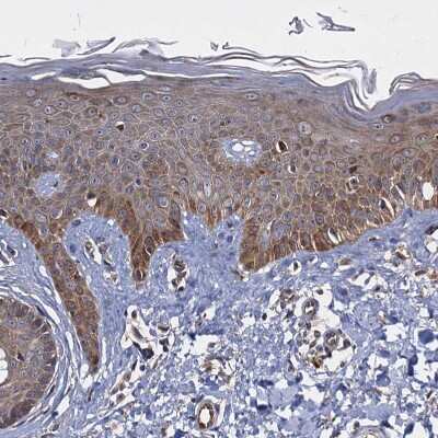 Immunohistochemistry-Paraffin: WWC3 Antibody [NBP1-90755] - Staining of human skin shows moderate  granular cytoplasmic positivity in squamous epithelial cells.