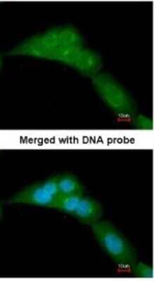 Immunocytochemistry/Immunofluorescence: WWOX Antibody [NBP1-33456] - Paraformaldehyde-fixed A549, using antibody at 1:200 dilution.